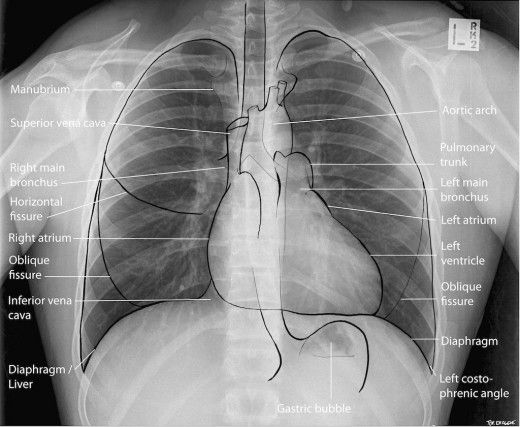Special_Investigations_In_Cardiology__Radiology_And_Electrocardiography_ECG.jpeg